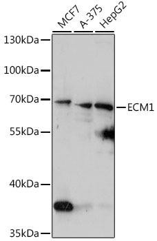 Cardiovascular Antibodies Anti-ECM1 Antibody CAB16368