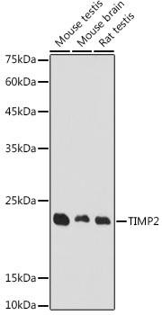 Cell Biology Antibodies 7 Anti-TIMP2 Antibody CAB16439
