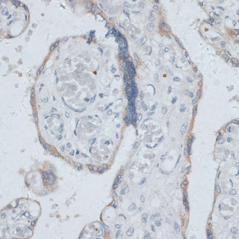 Signal Transduction Antibodies 2 Anti-DTNBP1 Antibody CAB16581