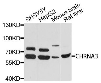 Signal Transduction Antibodies 2 Anti-CHRNA3 Antibody CAB1674