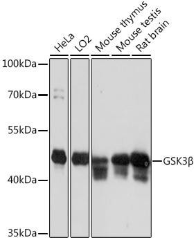 Cell Biology Antibodies 7 Anti-GSK3Beta Antibody CAB16868