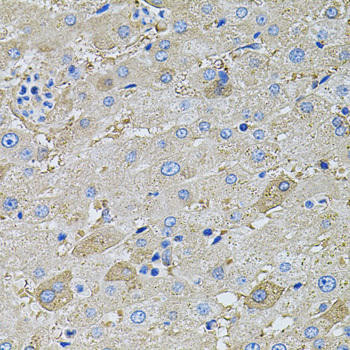 Cell Biology Antibodies 7 Anti-GLA Antibody CAB1700