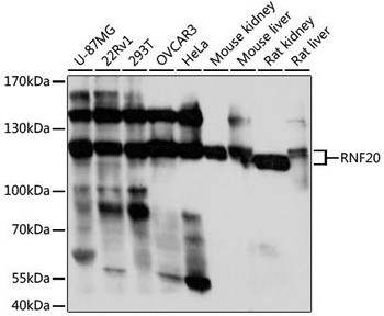 Signal Transduction Antibodies 2 Anti-RNF20 Antibody CAB17309