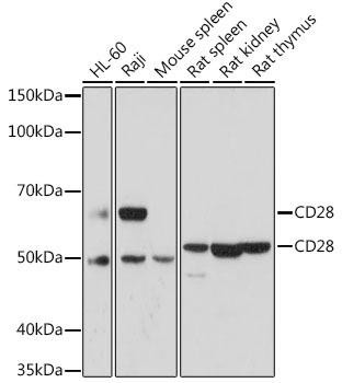 Cell Biology Antibodies 7 Anti-CD28 Antibody CAB17447