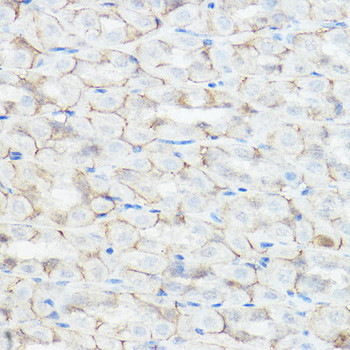Signal Transduction Antibodies 2 Anti-GABRA2 Antibody CAB1803