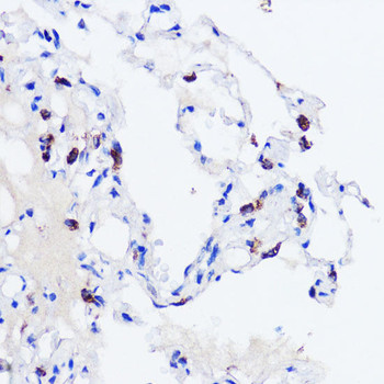 Cell Biology Antibodies 7 Anti-SFTPC Antibody CAB1835