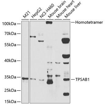 Cell Biology Antibodies 8 Anti-TPSAB1 Antibody CAB2022