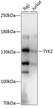 Cell Biology Antibodies 8 Anti-TYK2 Antibody CAB2128