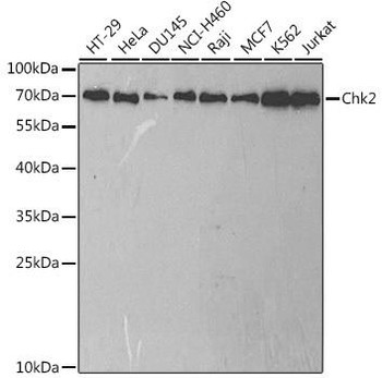Cell Death Antibodies 1 Anti-Chk2 Antibody CAB2145