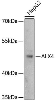 Epigenetics and Nuclear Signaling Antibodies 3 Anti-ALX4 Antibody CAB2834