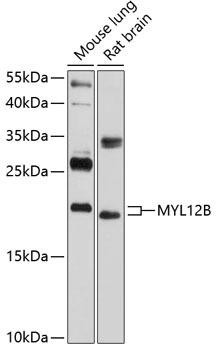 Cell Biology Antibodies 9 Anti-MYL12B Antibody CAB5104