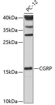 Cell Biology Antibodies 9 Anti-CGRP Antibody CAB5542