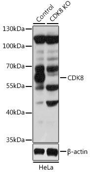 KO Validated Antibodies 1 Anti-CDK8 Antibody CAB5548KO Validated