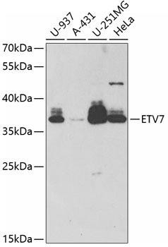 Epigenetics and Nuclear Signaling Antibodies 2 Anti-ETV7 Antibody CAB6255