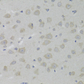 Cell Biology Antibodies 10 Anti-HSD17B13 Antibody CAB6256