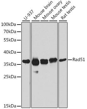 Epigenetics and Nuclear Signaling Antibodies 2 Anti-Rad51 Antibody CAB6268