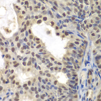 Cell Cycle Antibodies 1 Anti-CENPC Antibody CAB6557