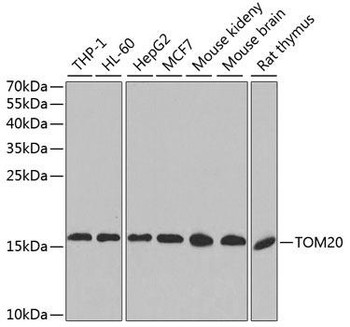 Cell Biology Antibodies 10 Anti-TOM20 Antibody CAB6774