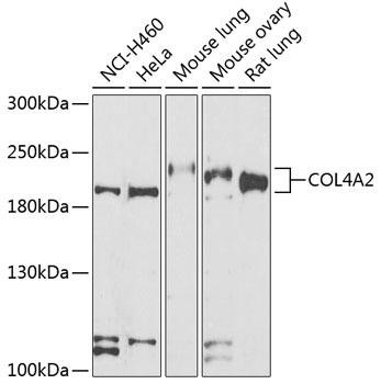 Cardiovascular Antibodies Anti-COL4A2 Antibody CAB7657