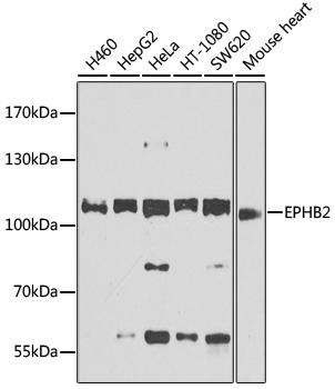 Neuroscience Anti-EPHB2 Antibody CAB9813