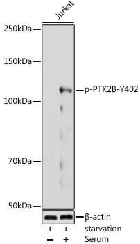 Immunology Antibodies 3 Anti-Phospho-PTK2B-Y402 Antibody CABP0214