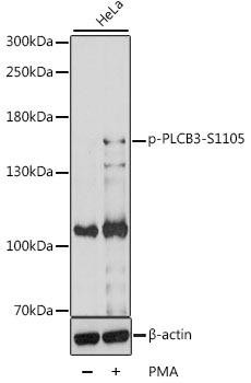 Metabolism Antibodies 3 Anti-Phospho-PLCB3-S1105 pAb Antibody CABP0837