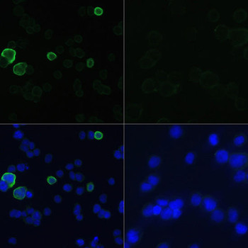 Protein Tags Anti-Mouse anti Myc-Tag Monoclonal Antibody CABE010