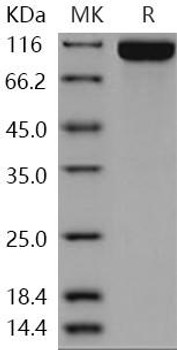 Human DPP10/DPRP3 Recombinant Protein (RPES0109)