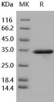 Human IL beta/IL1B Recombinant Protein (RPES0237)
