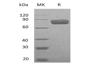 Mouse PD-L1/B7-H1/CD274 Recombinant Protein (RPES0266)