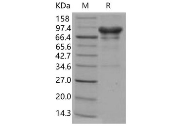 Carbonic Anhydrase 9/CA9 Recombinant Protein (RPES0372)