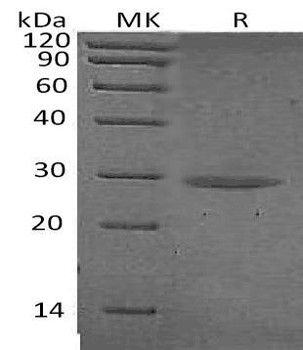Chymotrypsinogen B/CTRB1 Recombinant Protein (RPES0624)