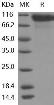Human HER2/ErbB2 Recombinant Protein (RPES1206)