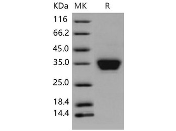 Mouse ASAM Recombinant Protein (RPES1273)