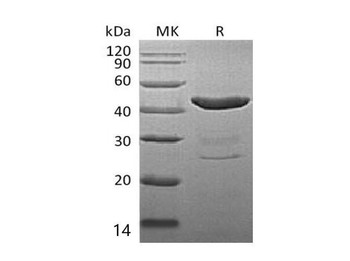 Mouse IDO1/IDO Recombinant Protein (RPES1334)