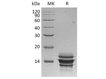 Human CXCL7/NAP-2 Recombinant Protein (RPES1426)