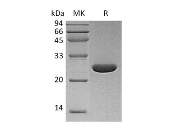 Human UCHL3/UCH-L3 Recombinant Protein (RPES1881)