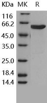 Human MKK6 Recombinant Protein (RPES1931)