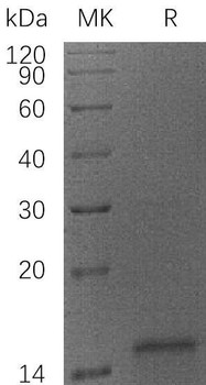 Human Cytochrome C/CYCS Recombinant Protein (RPES1958)