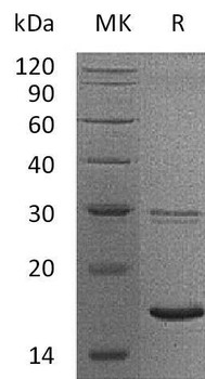 Human UBE2B/HR6B Recombinant Protein (RPES1961)