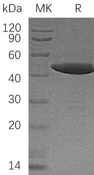 Human NCK1 Recombinant Protein (RPES2020)