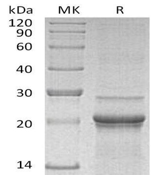 Mouse Interleukin-6/IL-6 Recombinant Protein (RPES2025)