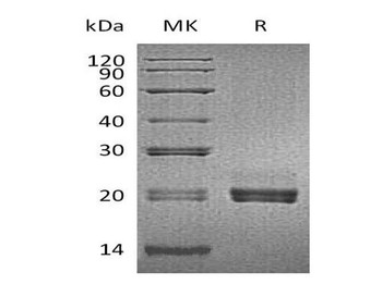 Mouse CD40LG/TNFSF5 Recombinant Protein (RPES2031)