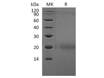 Human CTLA4 Recombinant Protein (RPES2041)