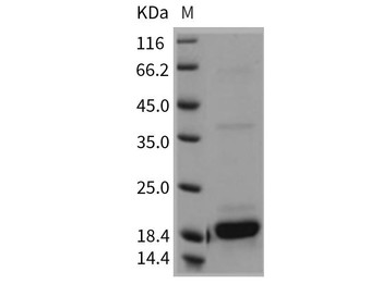Mouse Interleukin-2/IL-2 Recombinant Protein  (RPES2056)