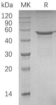 Human POLD2 Recombinant Protein (RPES2482)