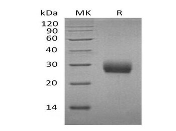 Mouse RANK/TNFRSF11A Recombinant Protein (RPES2691)