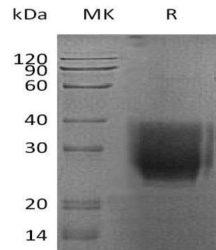 Human CD147/Basigin Recombinant Protein (RPES2767)