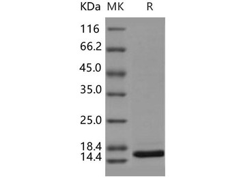 Human DIM1/TXNL4A Recombinant Protein (RPES2778)