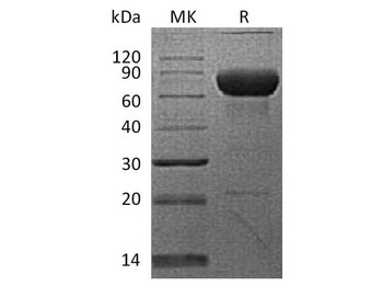 Cynomolgus PD-L2/B7-DC/CD273 Recombinant Protein (RPES2939)